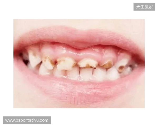 韦林顿确诊上唇部贯通伤;11、21牙半脱位;上颌前牙区牙槽骨骨折 韦林顿确诊上唇部贯通伤;11、21牙半脱位;上颌前牙区牙槽骨骨折